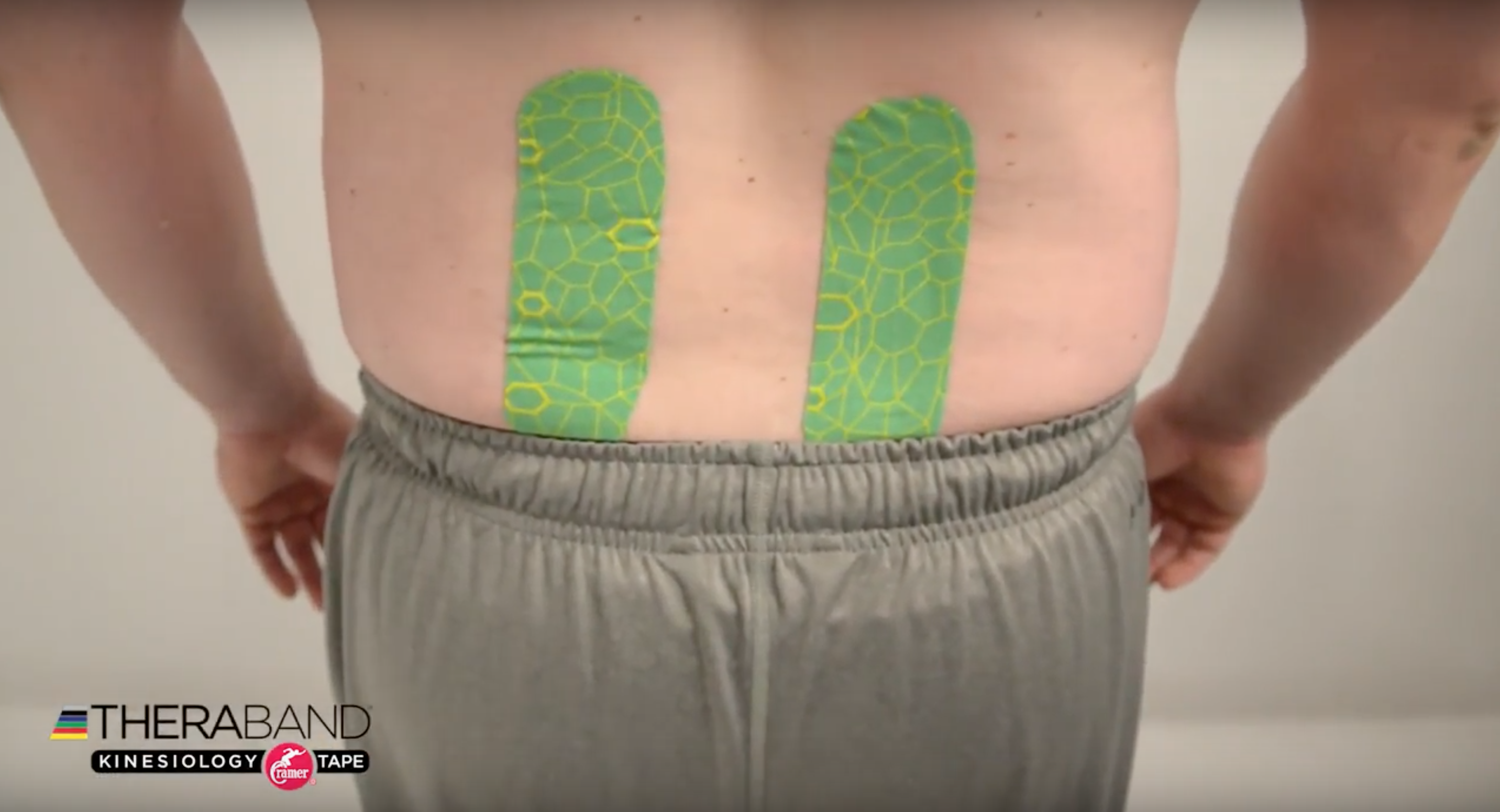 Kinesiology Taping Technique for Low Back Pain ...