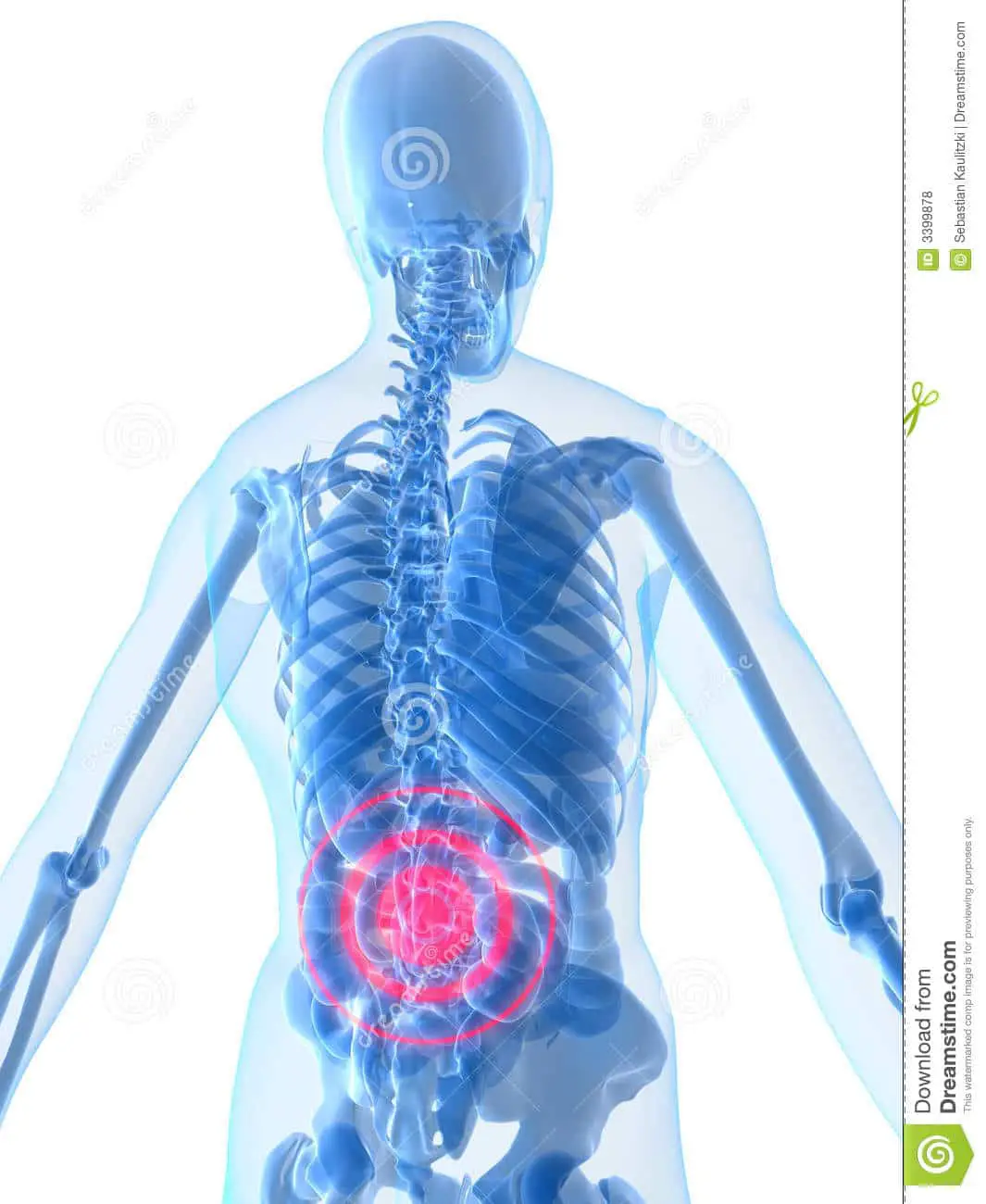 Lower back inflammation stock illustration. Illustration of spine