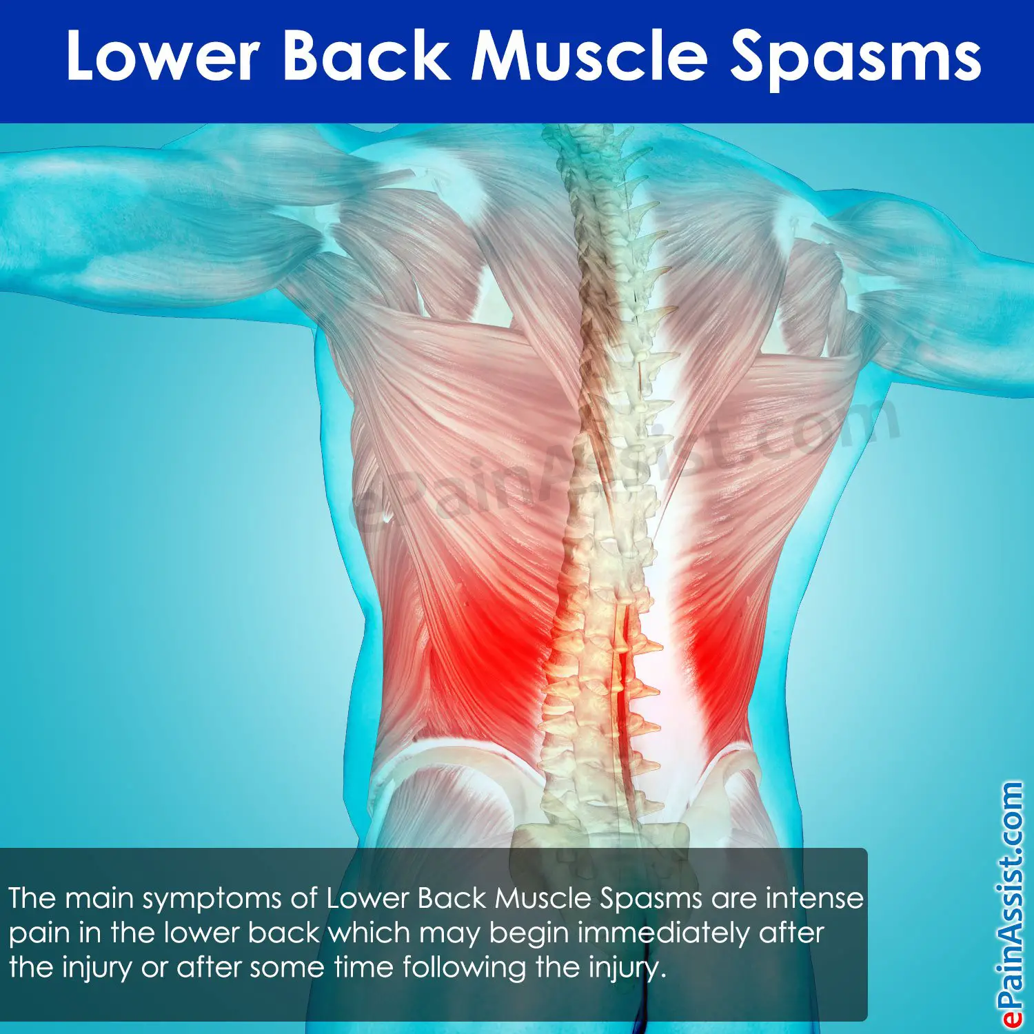 Lower Back Muscle Spasms: Treatment, Causes, Symptoms