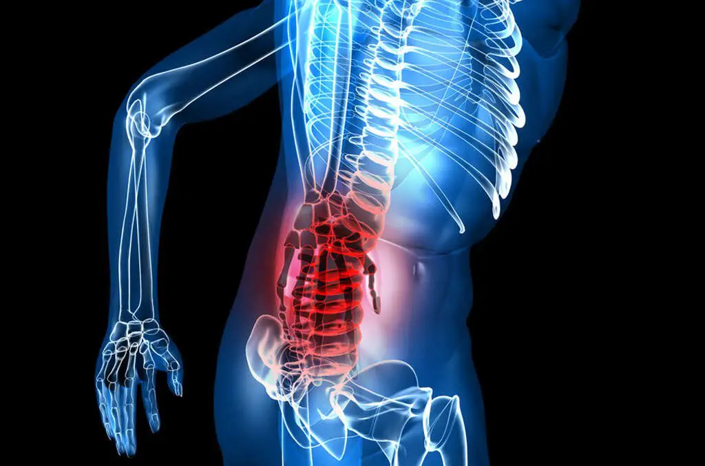 Lower Back Pain: 10 Causes of Lower Back Pain