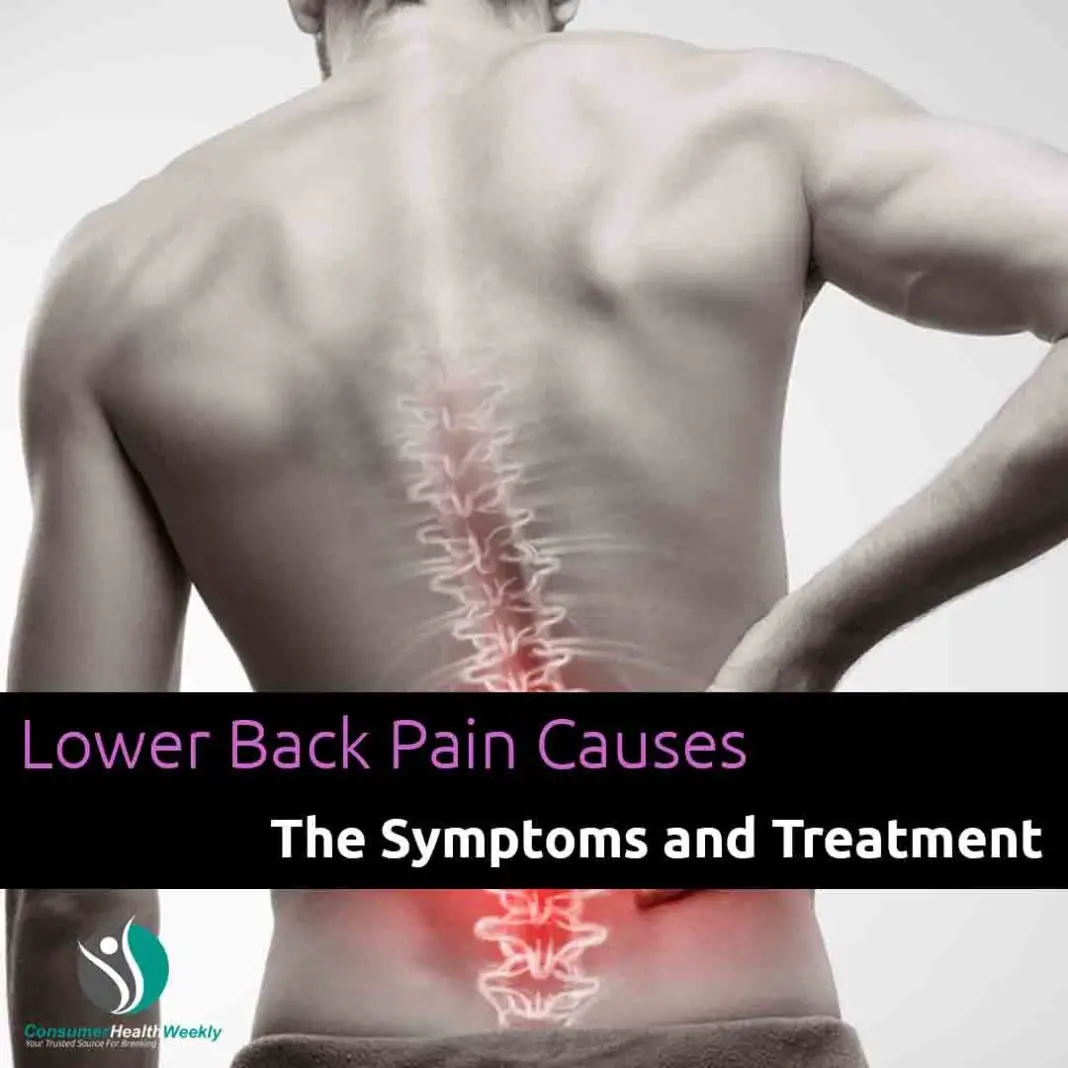 Lower Back Pain Causes