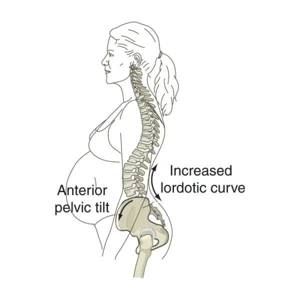 Lower Back Pain during Pregnancy  Physio Dublin  Laurel Lodge ...