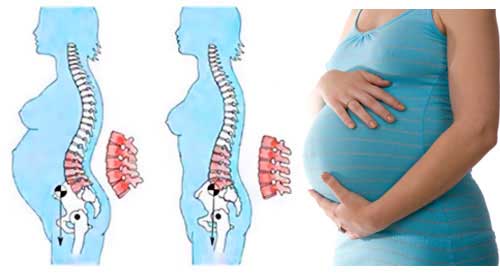 Lower Back Pain Early Pregnancy