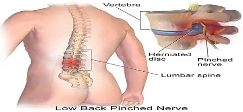 Lower Back Pain Left Side Only