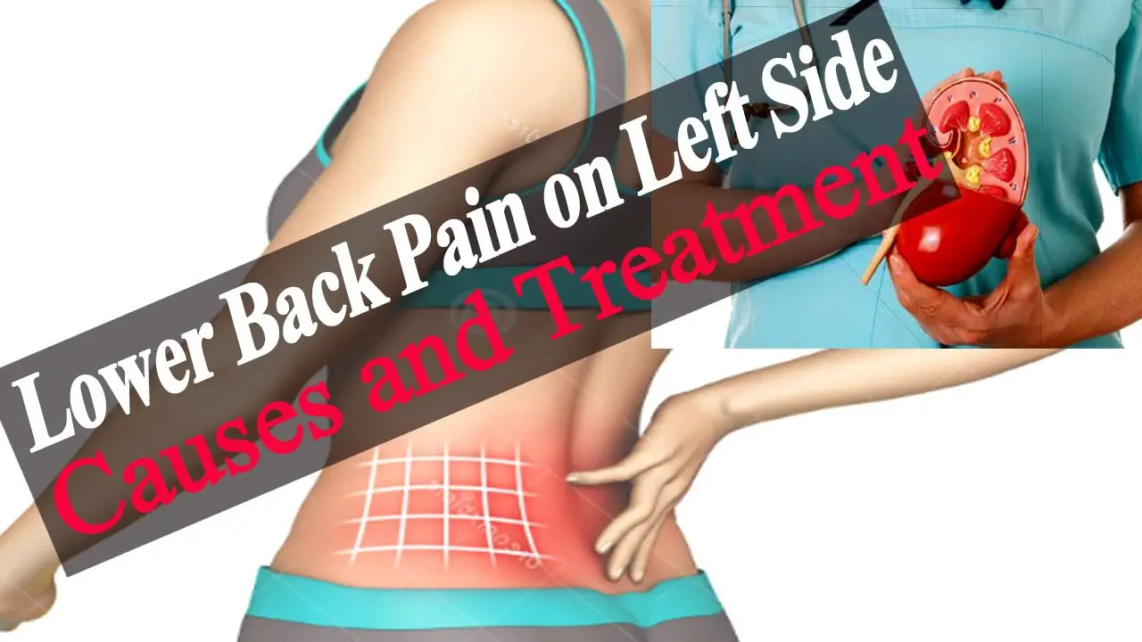Lower Back Pain on Left Side  Causes of Lower Back Pain ...