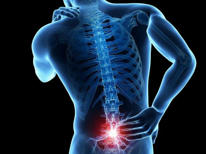 Lower Back Pain Surgery