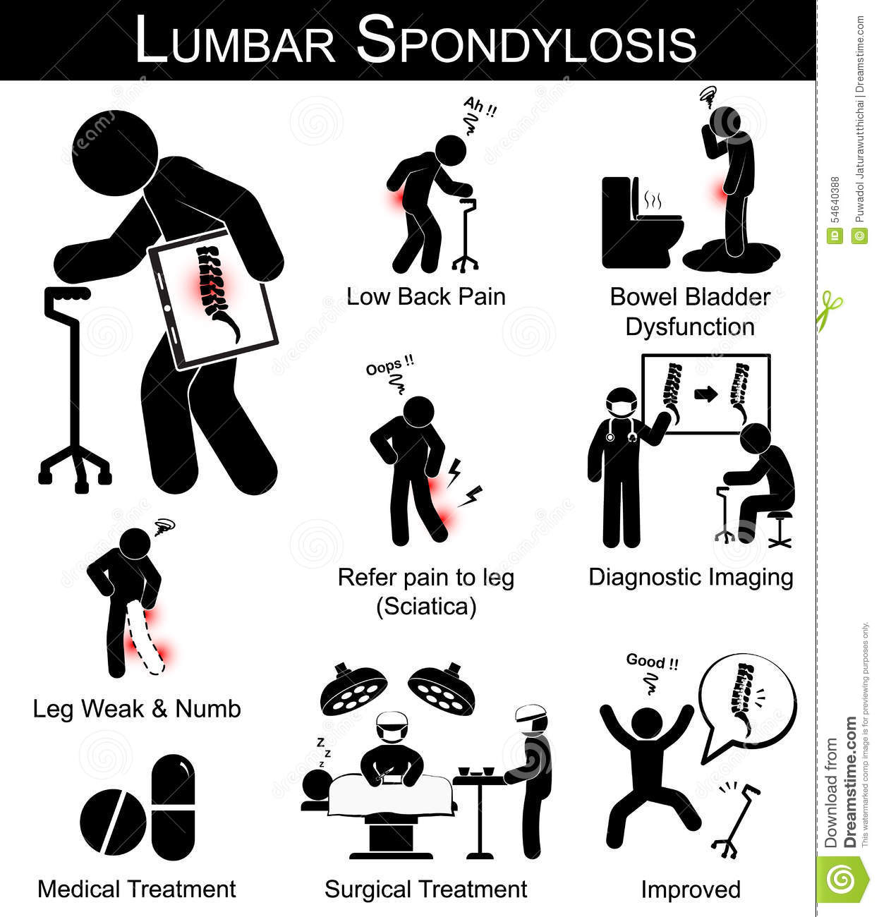 Lumbar Spondylosis Symptoms Pictogram Stock Vector ...