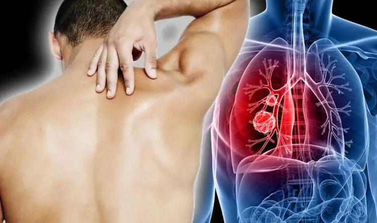 Lung cancer symptoms: Signs of a tumour include lower back pain