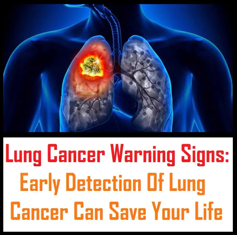 Lung Cancer Warning Signs: Early Detection Of Lung Cancer Can Save Your ...
