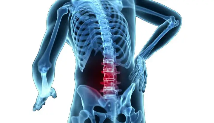 Mechanical Back Pain