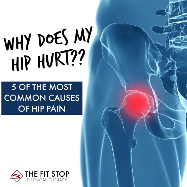Most common causes of hip pain
