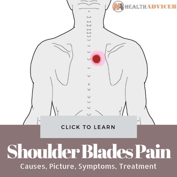 Pain Between Shoulder Blades: Symptoms, Diagnosis And ...