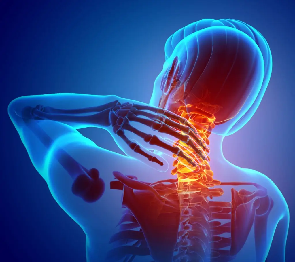 Pain in the back of the neck: causes, Treatments and home ...