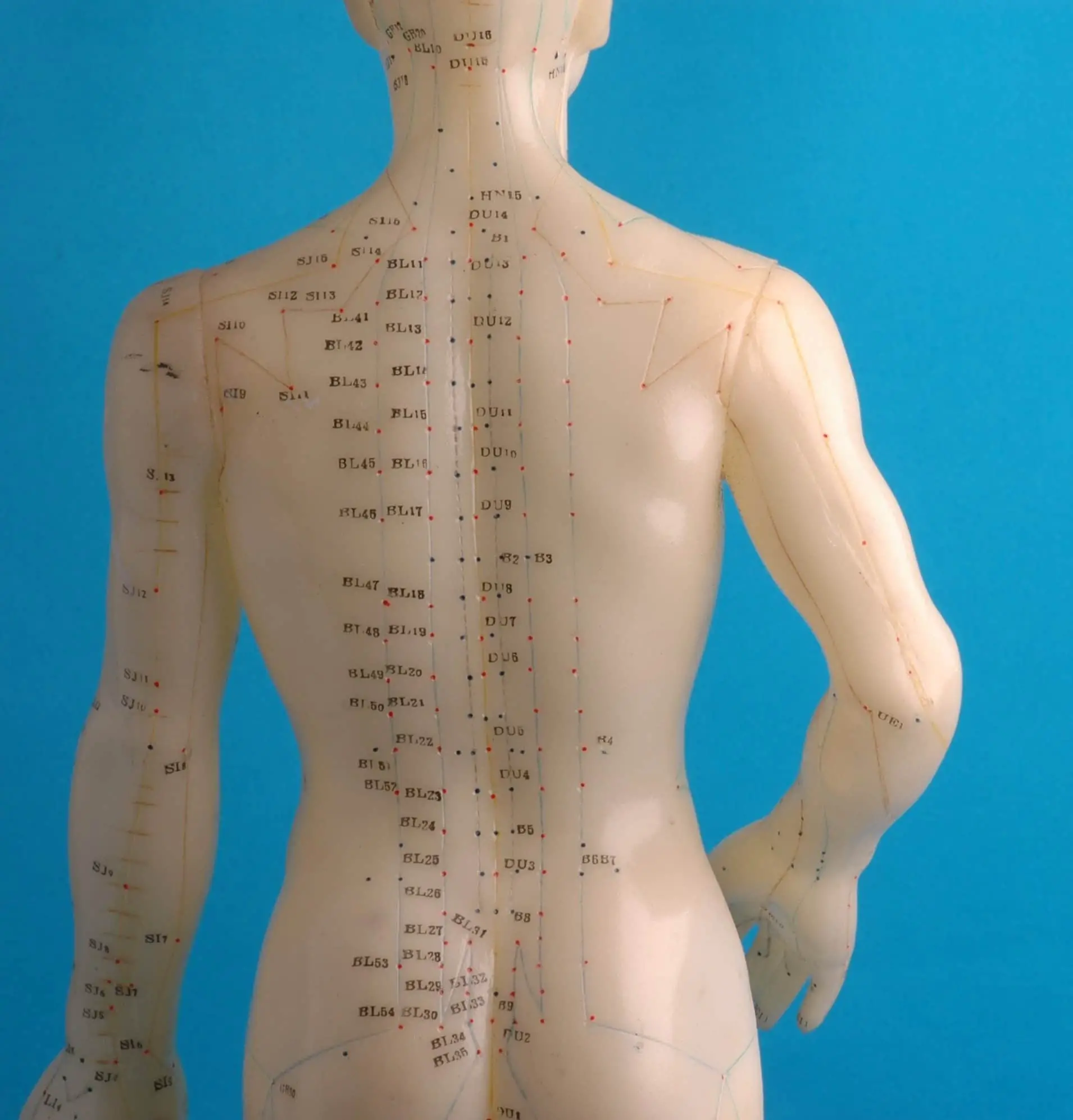 Pain Relief Acupuncture
