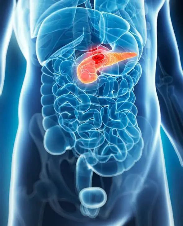 Pancreatic cancer symptoms: What are the symptoms of pancreatic cancer ...