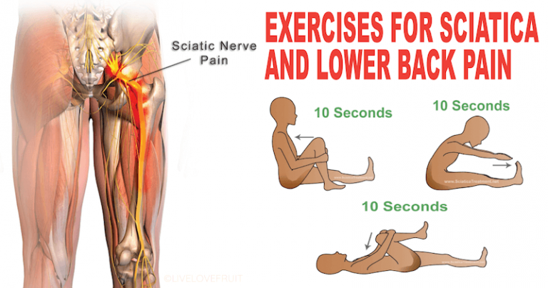How To Relieve Sciatic Nerve Pain In Lower Back
