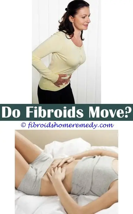 Pin on Uterine Fibroid Removal