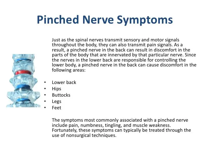Pinched Nerve in the Back