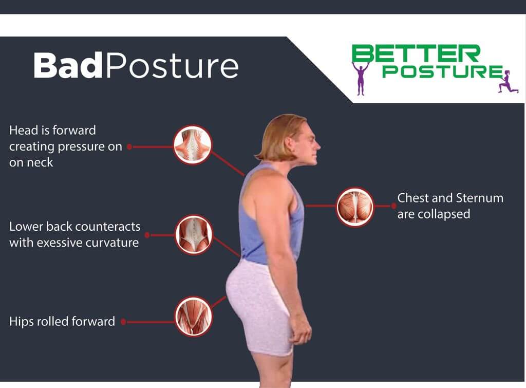 Postural Strengthening Exercises, Forward Head Posture ...