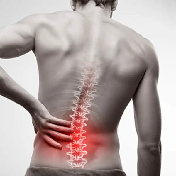Schluter Chiropractic Â» The Top Causes of Low Back Pain
