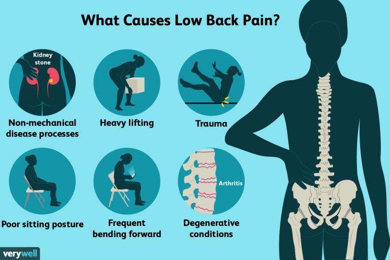 What Is Lower Back Pain Caused From