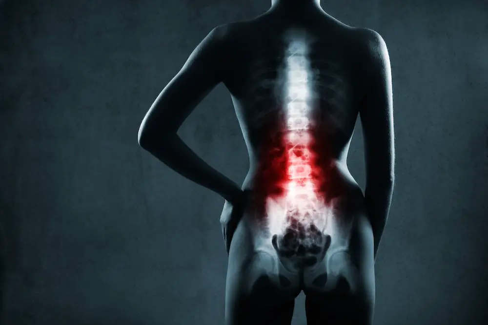 Severe Back Pain After a Car Accident