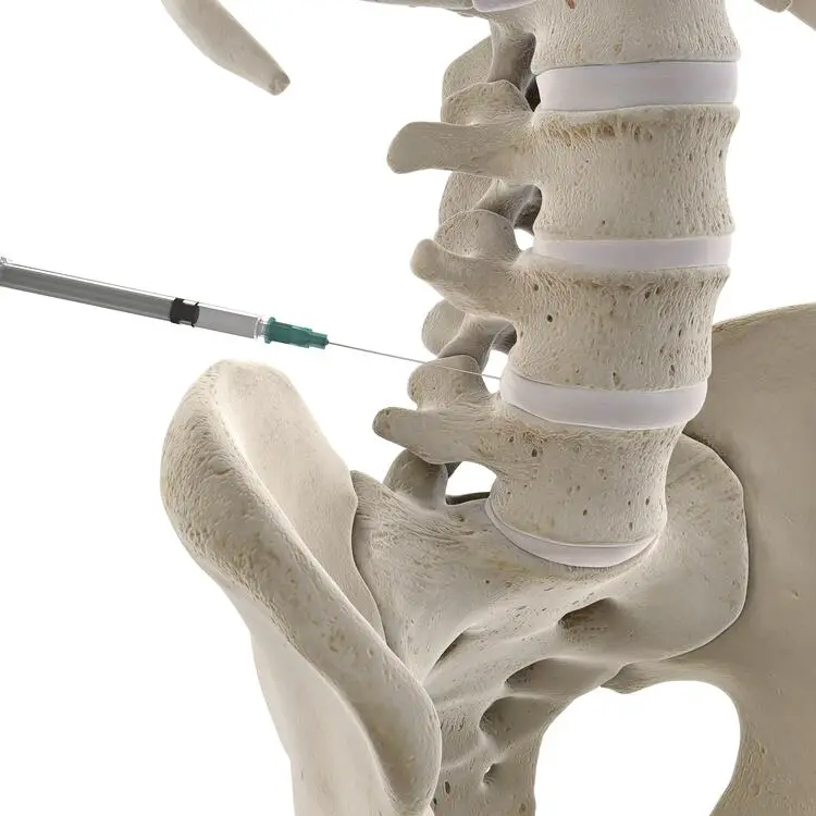 Spinal Injections Baton Rouge