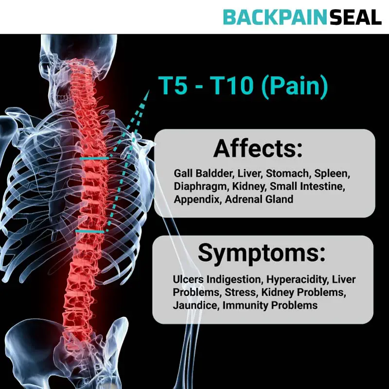 The Hidden Side Effects of Back Pain