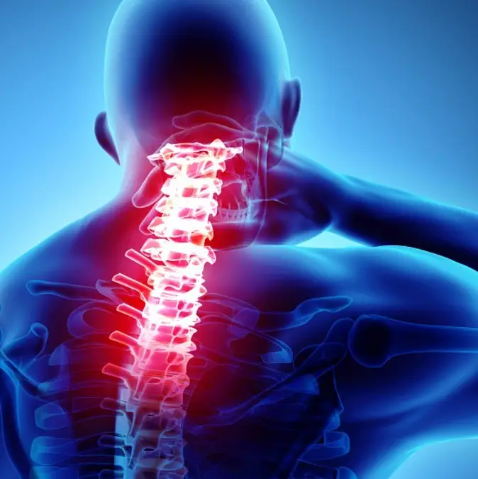 The most common cause of Neck pain