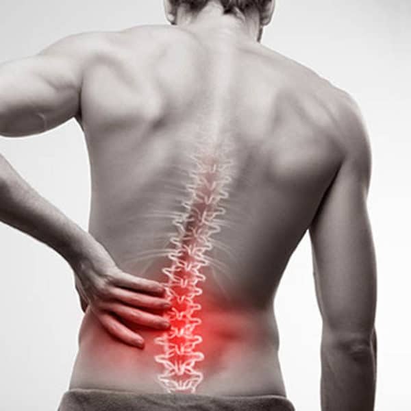 The Top Causes of Low Back Pain