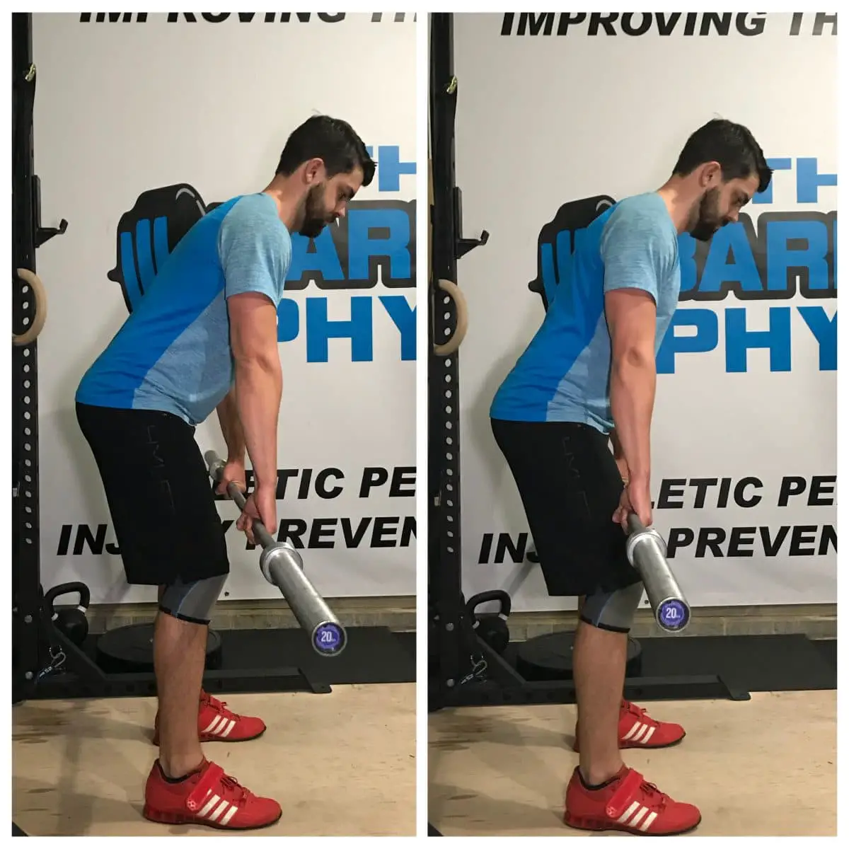 Treating Low Back Pain Using DEADLIFTS