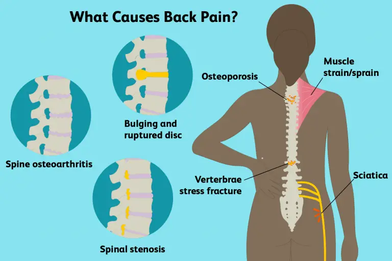 What To Do When Your Lower Back Hurts Really Bad