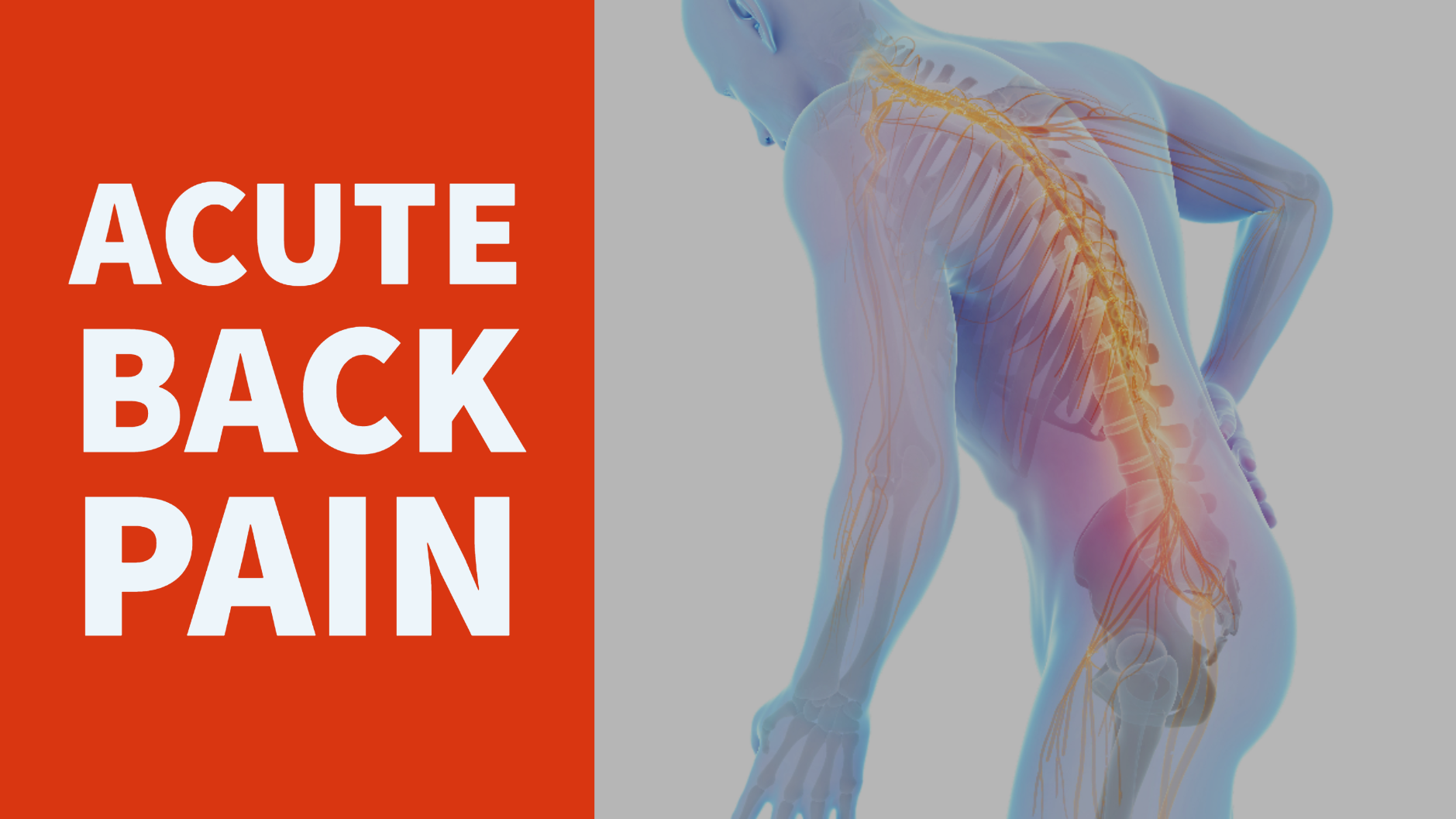 VIDEO: Acute Back Pain