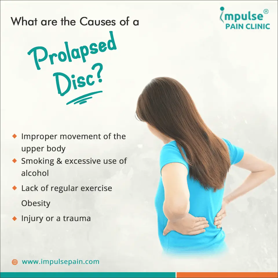 What are the Causes of a Prolapsed Disc?