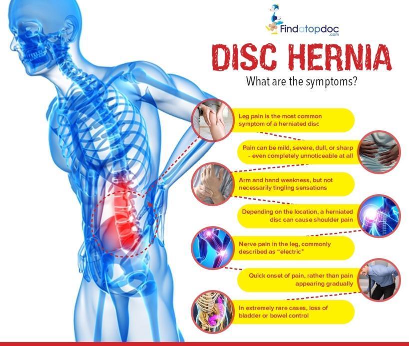 What are the symptoms of Disc Hernia? [Infographic]