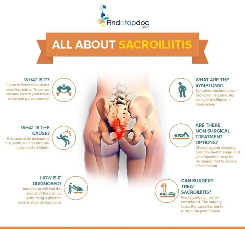 What are the Symptoms of Sacroiliitis? [Infographic]
