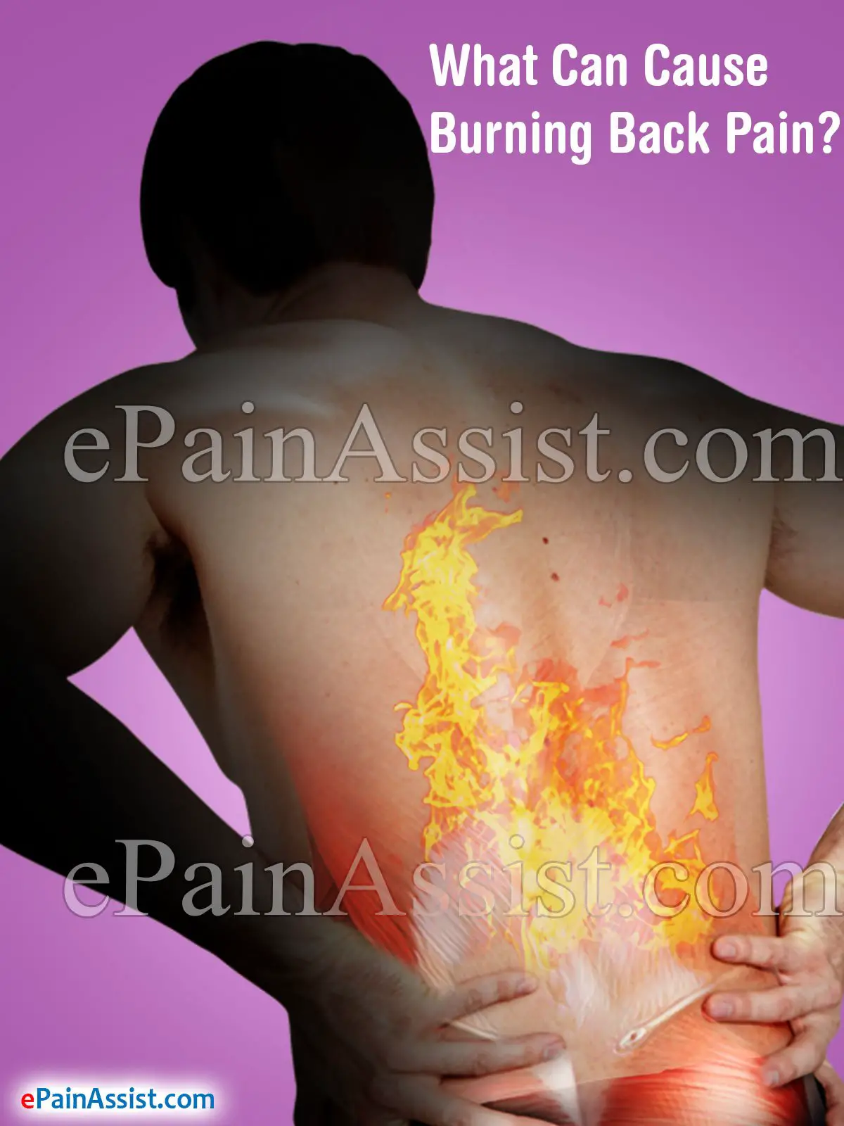 What Can Cause Burning Back Pain?