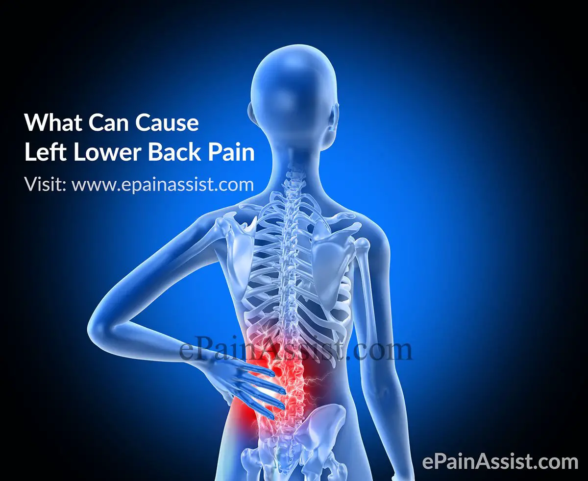 What Can Cause Left Lower Back Pain