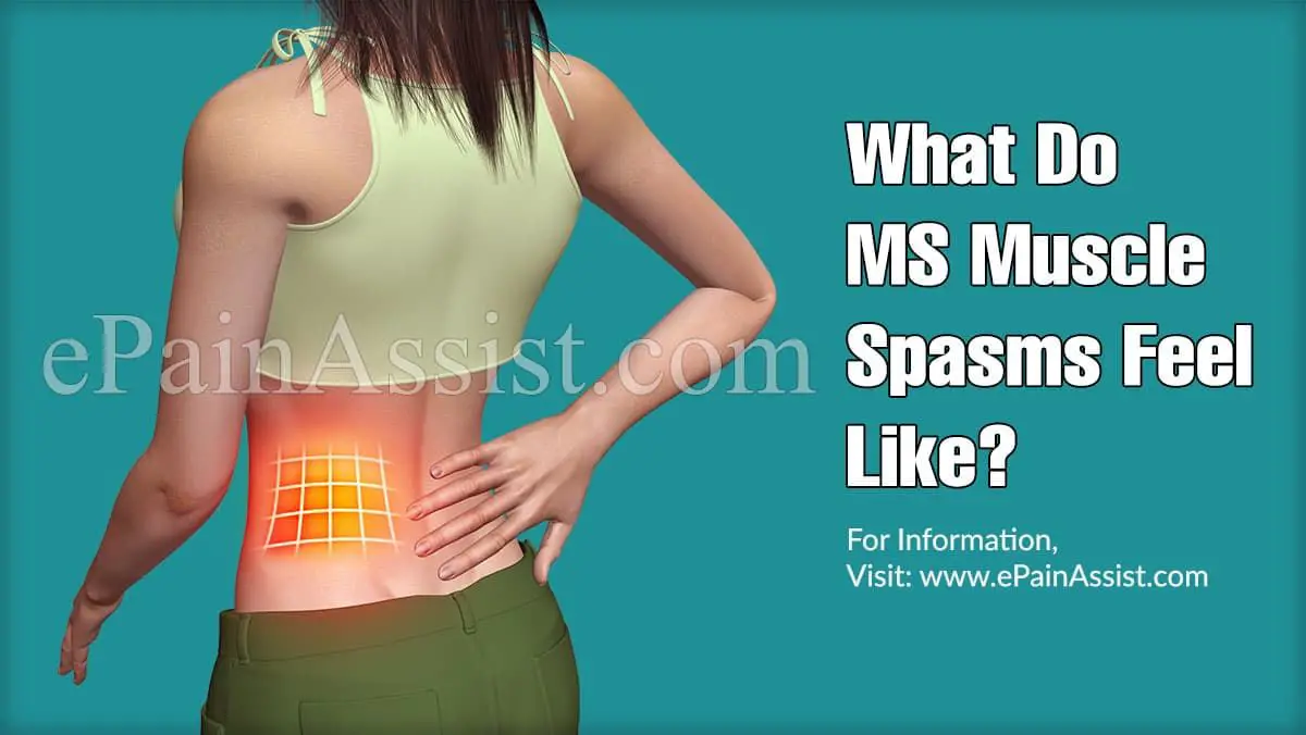 What Do MS Muscle Spasms Feel Like?