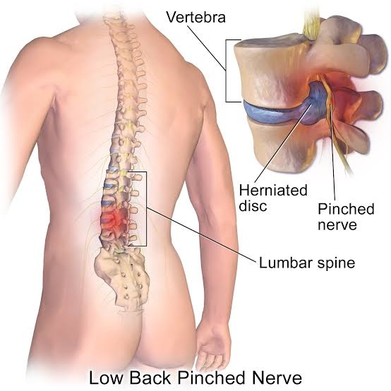 What does it mean when the left side of my lower back ...