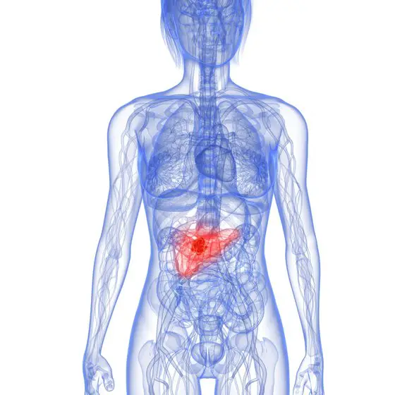 What Does Pancreatic Cancer Back Pain Feel Like