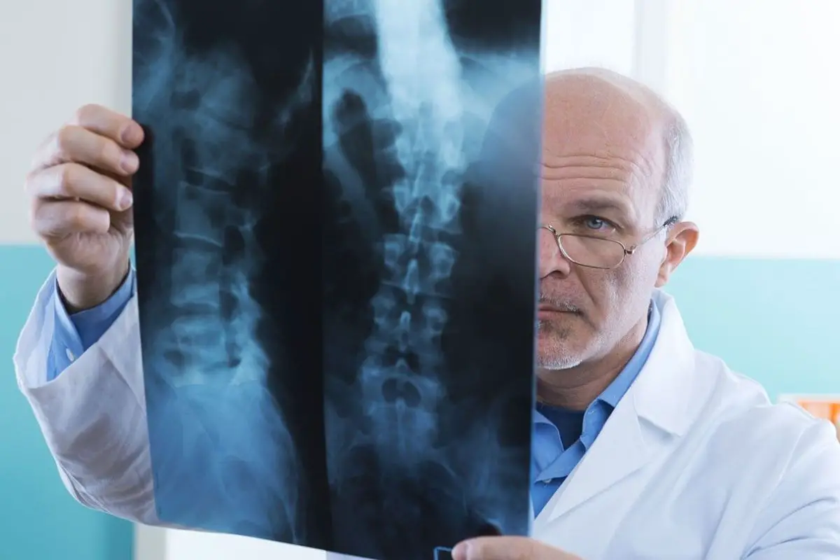 What Does Spinal Arthritis Feel Like?