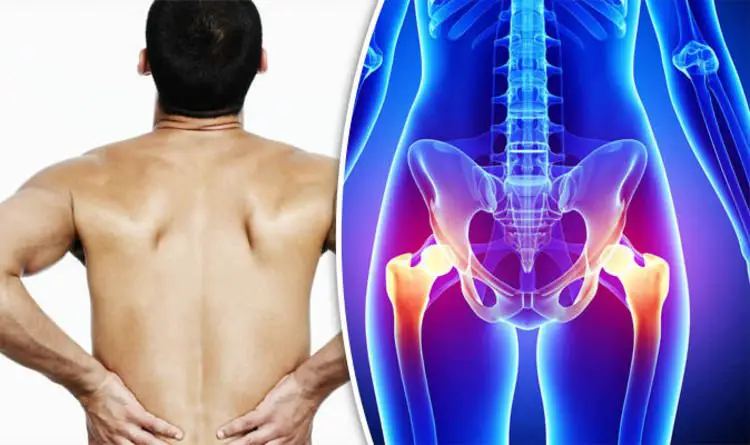 What is causing the pain in my hip and back? DR ROSEMARY answers your ...