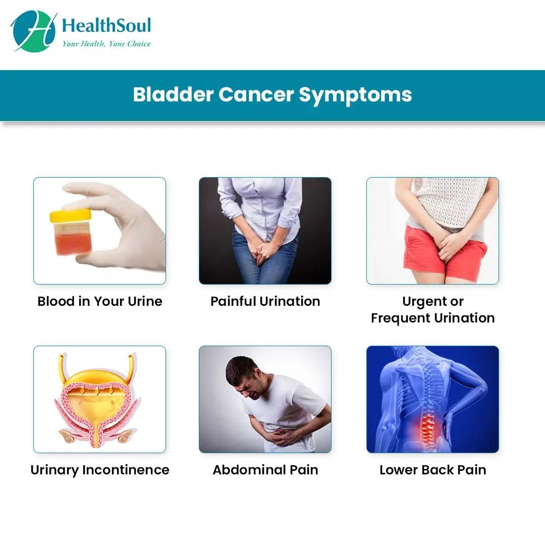 What Is The First Sign Of Bladder Cancer