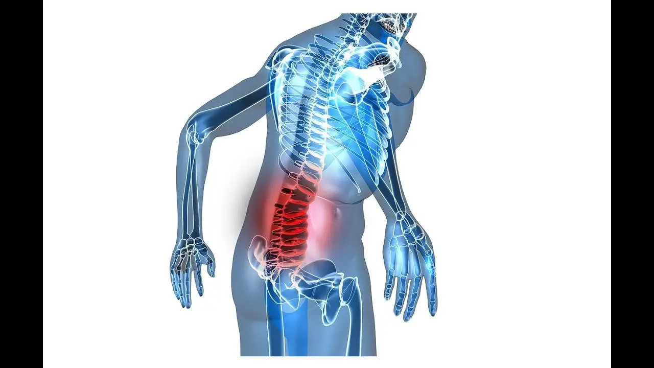 What To Do When You Strain Your Lower Back
