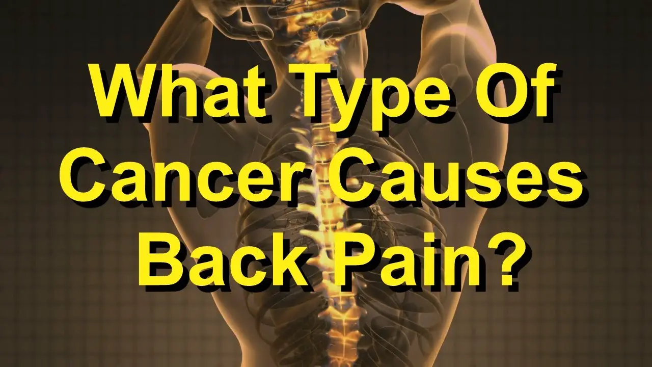 What Type Of Cancer Causes Back Pain?