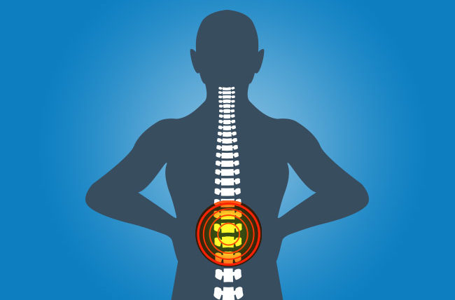 When Back Pain Means More Than a Back Problem  Cleveland Clinic