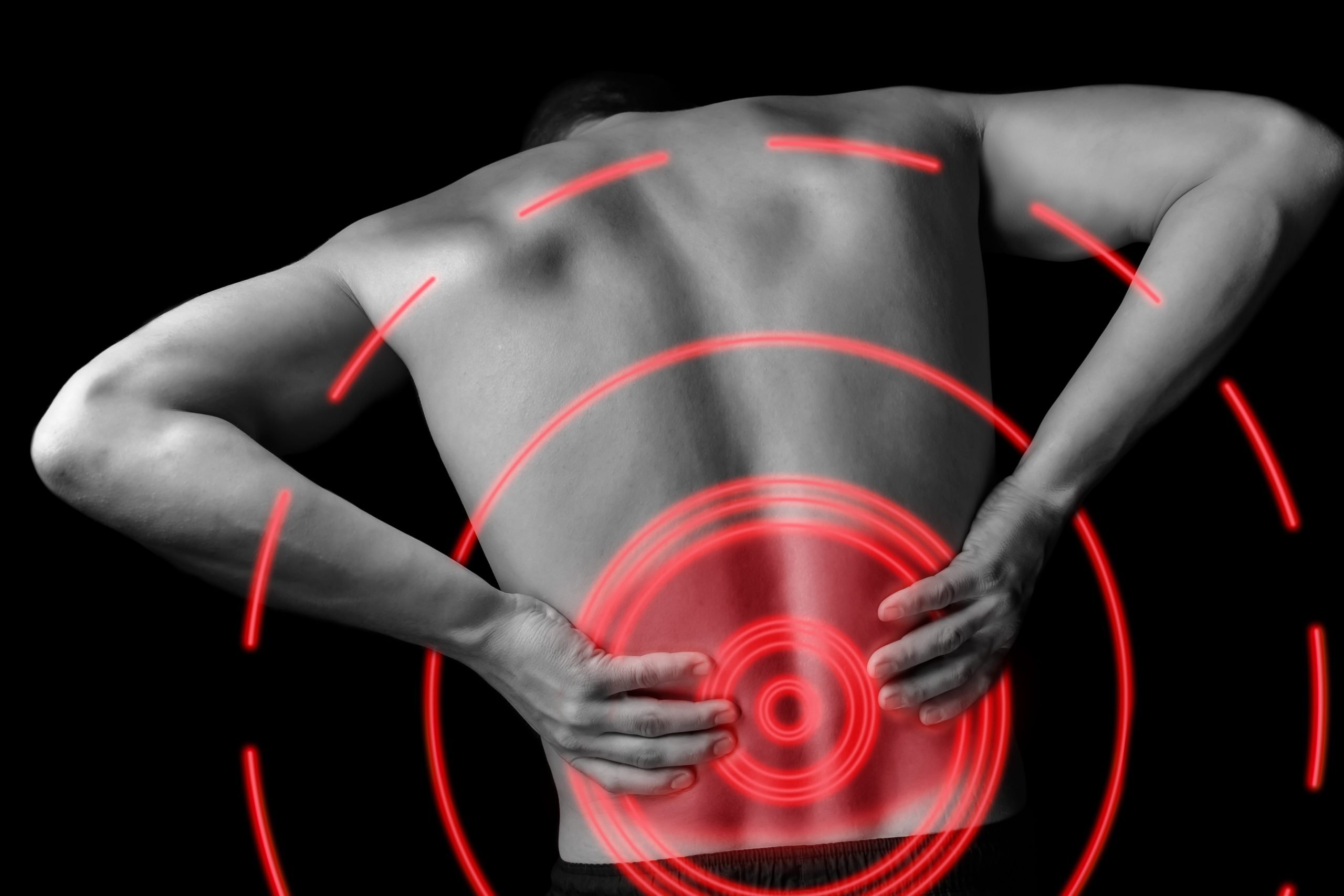 When to Suspect Your Lower Back Pain Is Actually Sciatica ...