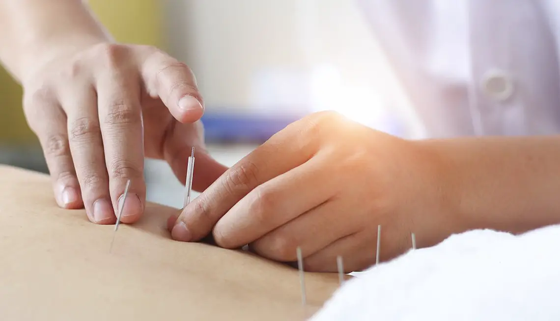 Who Should Use Acupuncture for Chronic Back Pain?