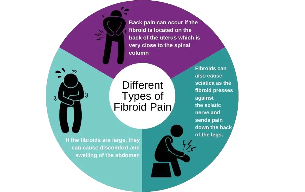Why Fibroids Cause Leg and Back Pain